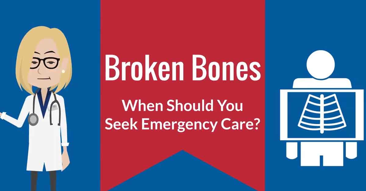 Broken Bones Emergencies