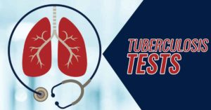 Tuberculosis Tests