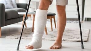 4 Signs to Know if You Have a Broken Leg